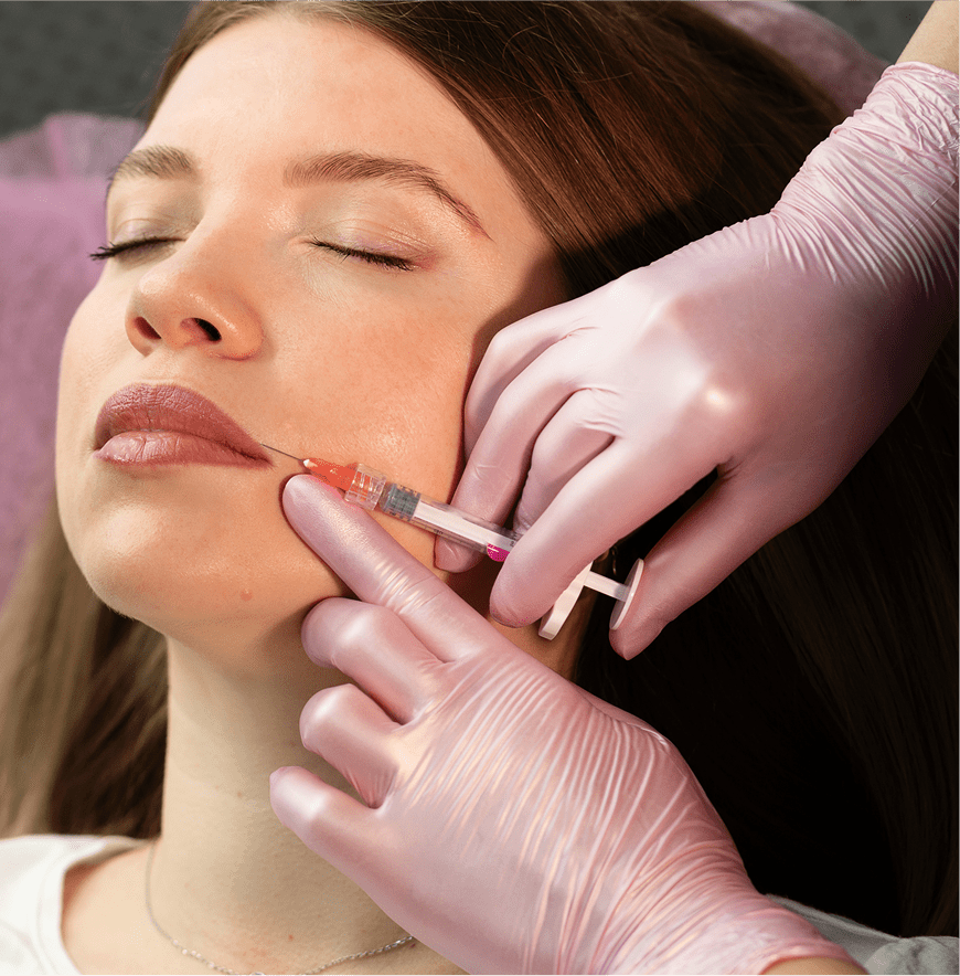 Cosmetic lip enhancement with syringe