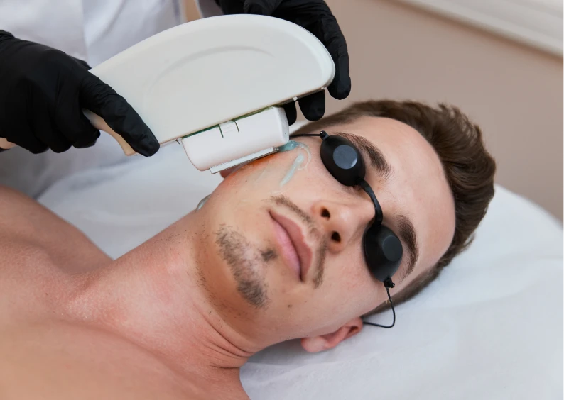 Man receiving facial laser therapy